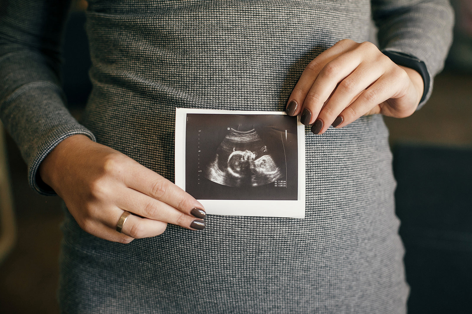 [UAE] Alpha Nero sets new standard with 70-day paid maternity leave policy